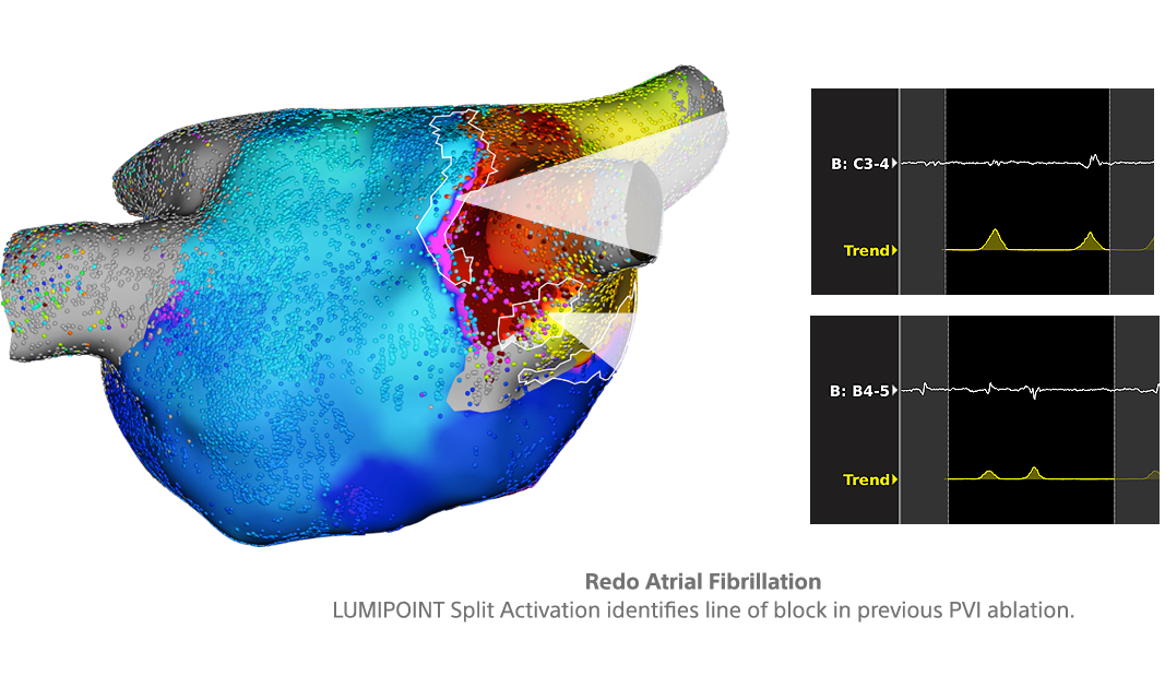 LUMIPOINT Software Module RHYTHMIA HDx Boston Scientific